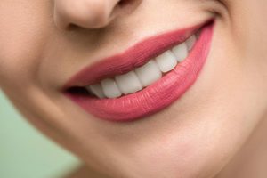 sorriso denti - dentista - bocca - pexels- corrierecomo